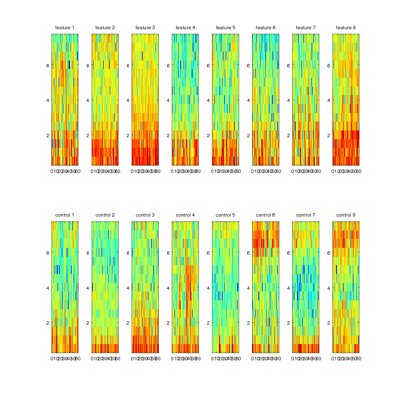 eeg-spectrogram.png